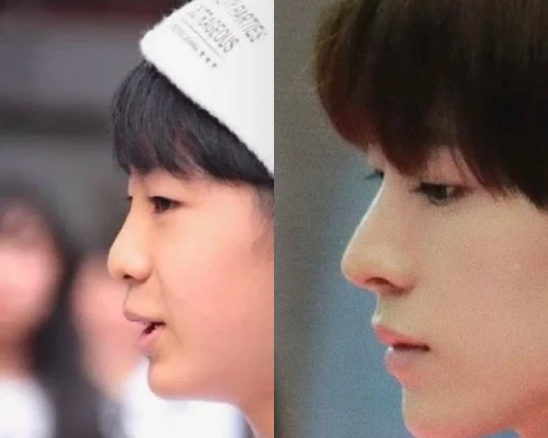 NCT Wishリク、「鼻」整形変化に反響！「HYBEに比べて、SM整形上手い」の声